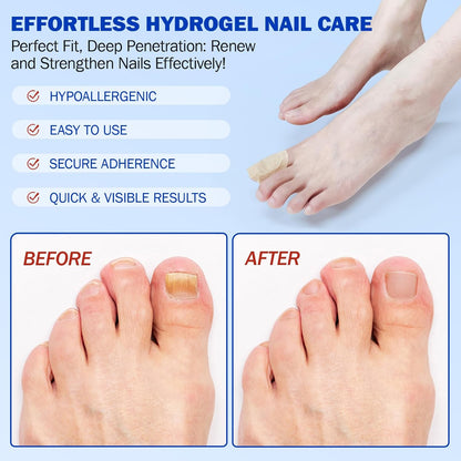 Nail Antibacterial Fungus Patch